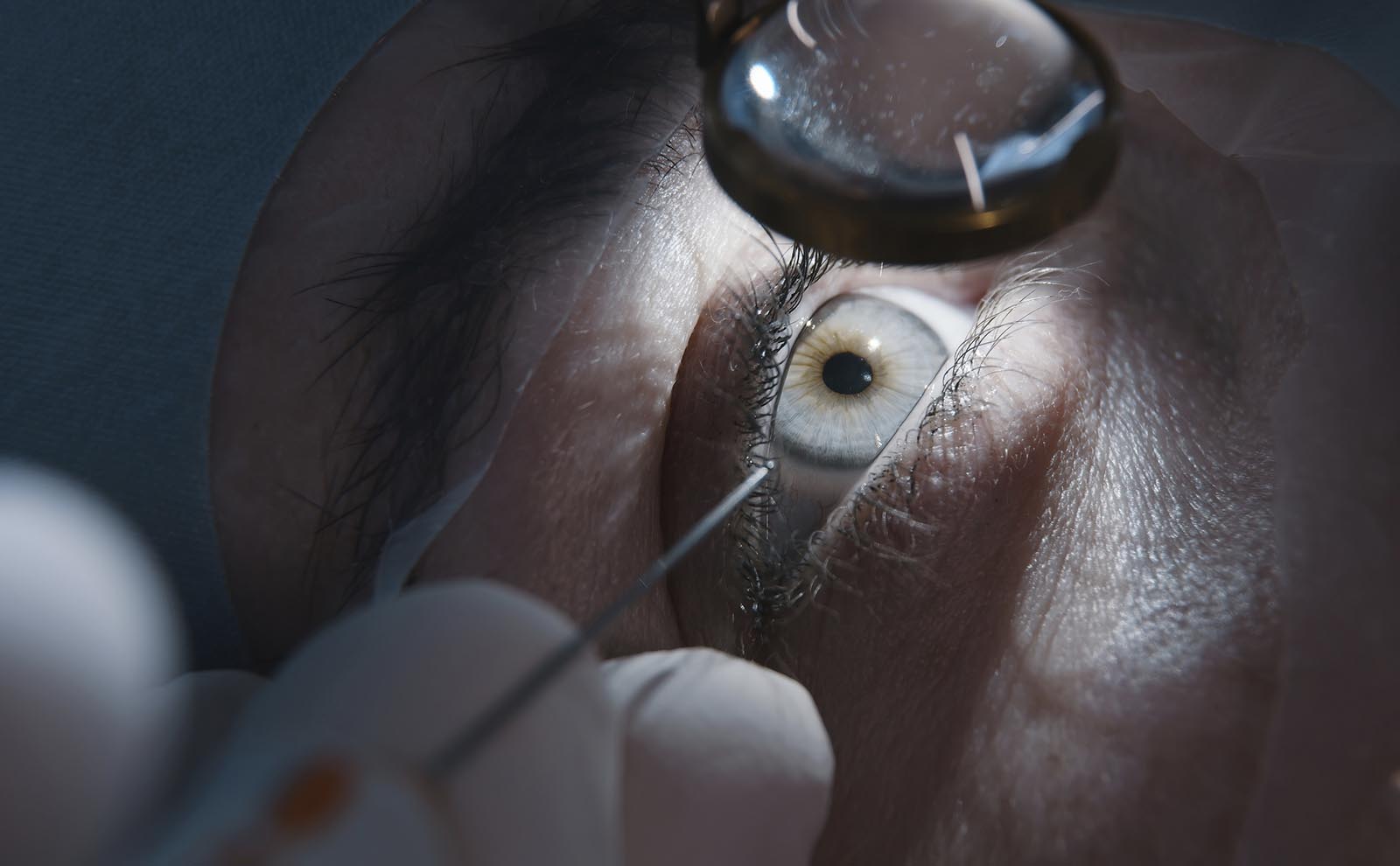 Eye doctor examining eye under scope